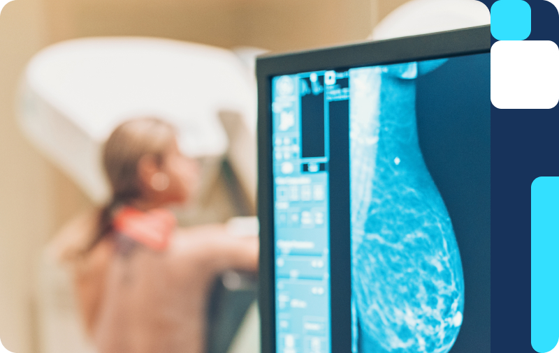 northside-hospital-breast-cancer