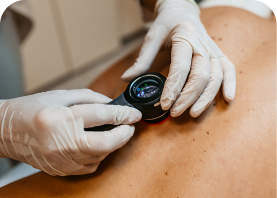 skin-cancer-thumbnail (1)